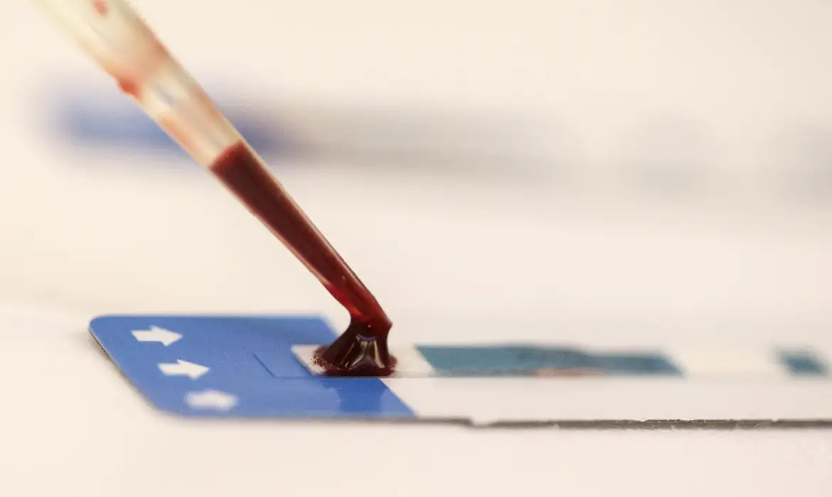 Estudo inédito da Fiocruz pode ampliar prevenção de HIV entre jovens